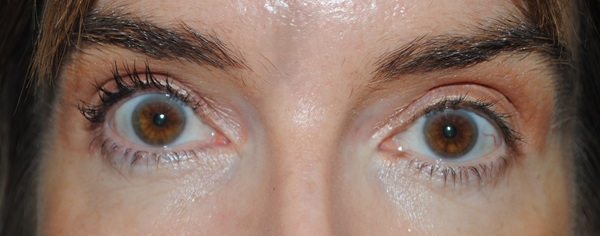 Hildun Beauty Power Precision Peptide Mascara Review 7 After: Hildun Beauty Power Precision Peptide Mascara in Black (Noir) - 1 Coat